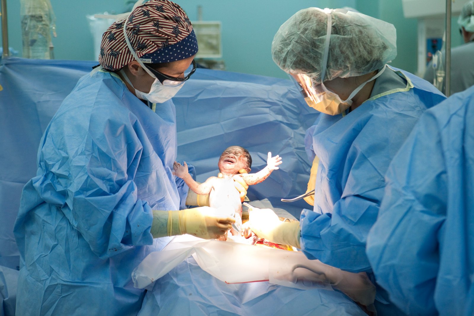 Safe cesarean section delivery performed at the best C-section hospital in Bhopal by Dr. Praveena Agarwal, Cosmetic Gynaecologist
