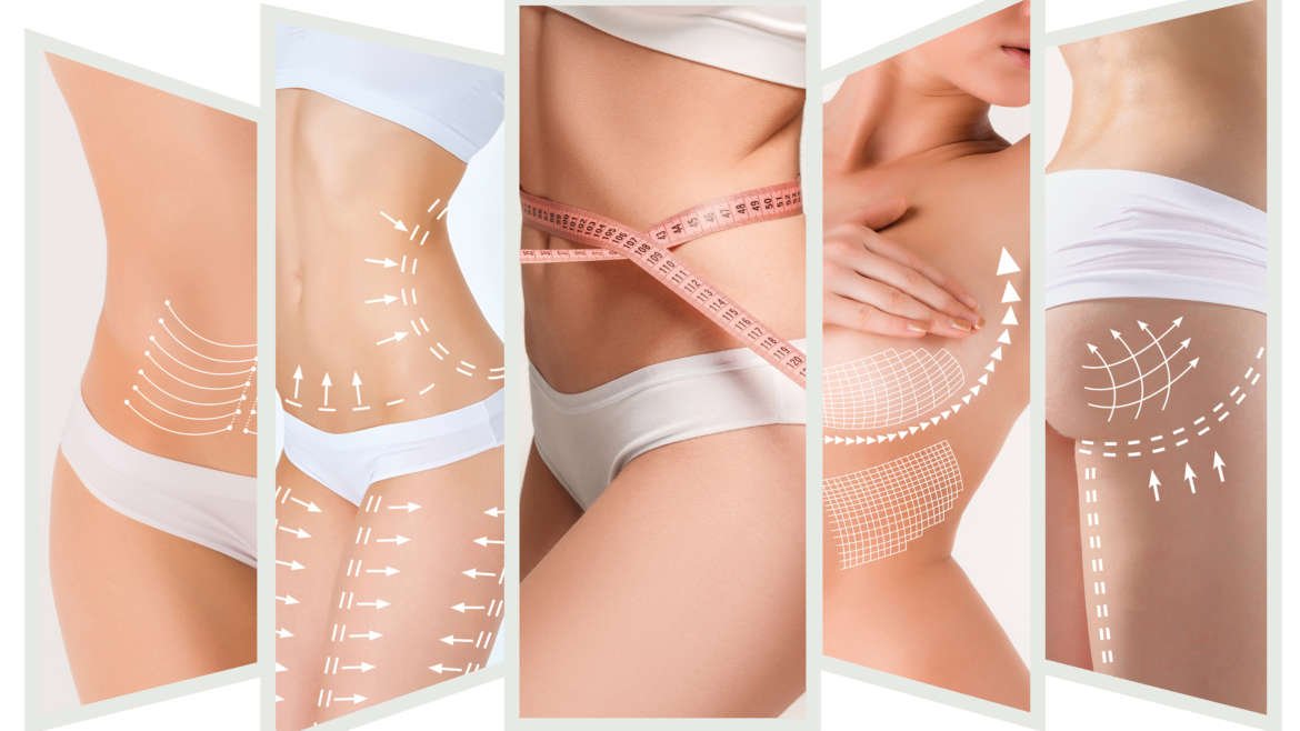 Body contouring and aesthetic treatment services by Dr. Praveena Agarwal – Cosmetic Gynaecologist in Bhopal at Jeevan Jyoti Maternity & Nursing Home