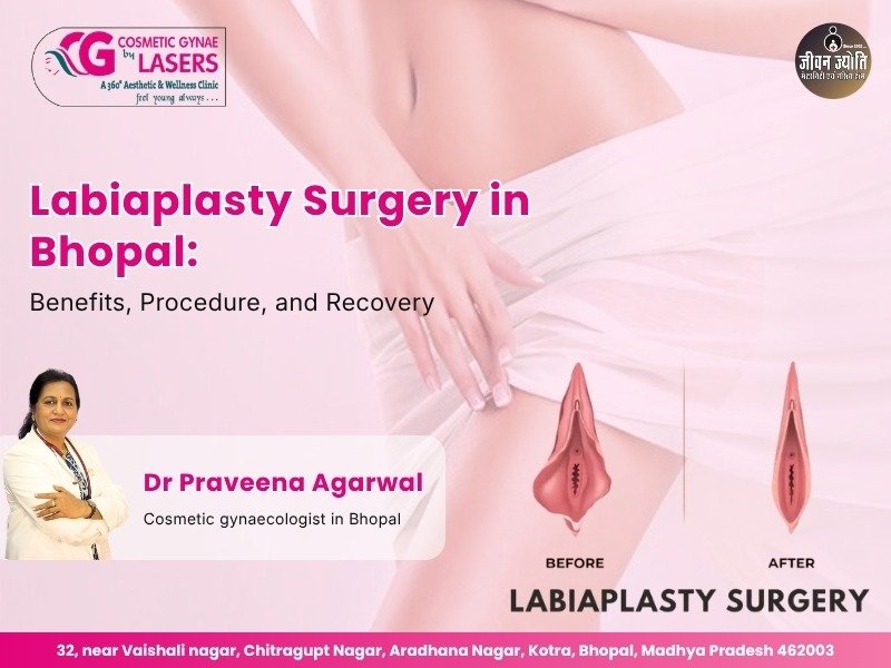 Labiaplasty Surgery in Bhopal showing before and after illustration explained by Dr. Praveena Agarwal Cosmetic Gynaecologist