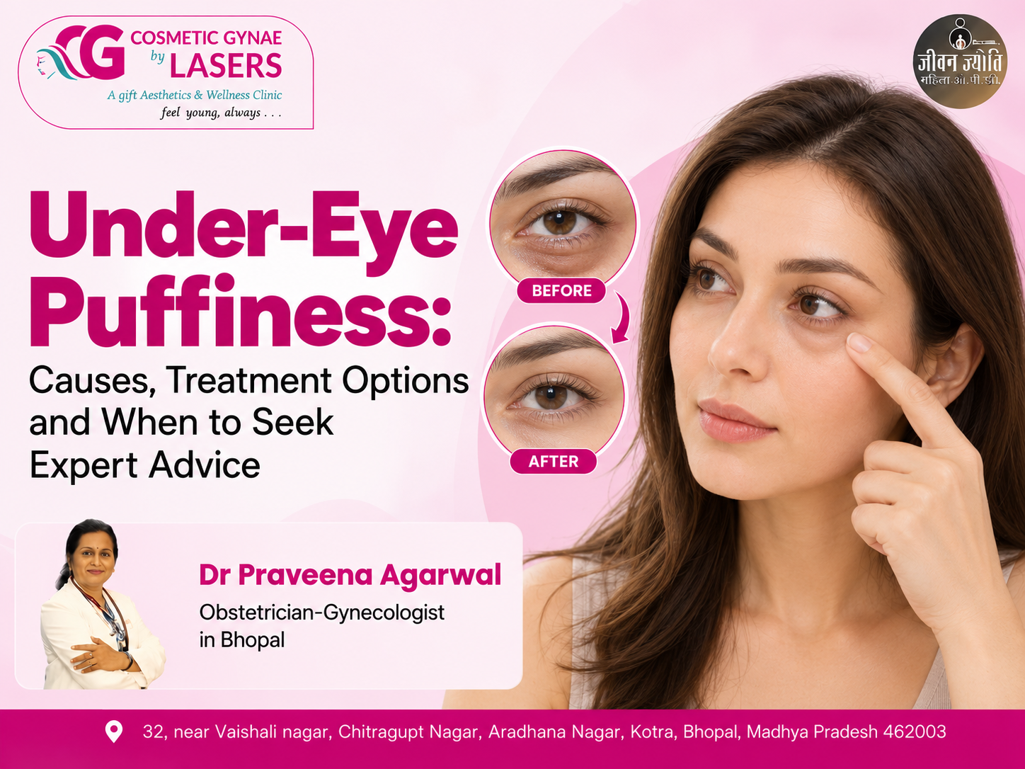 Under-Eye Puffiness: Causes, Treatment Options and When to Seek Expert Advice  Dr. Praveena Agarwal